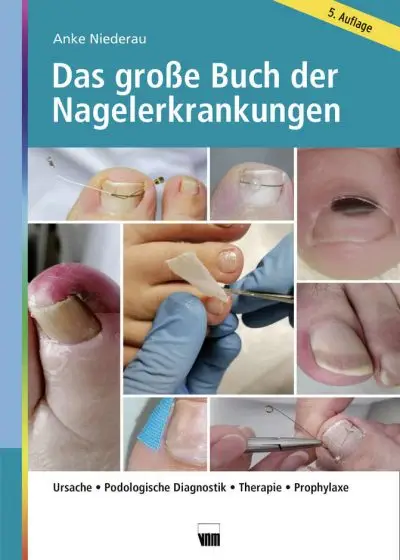 Das große Buch der Nagelerkrankungen