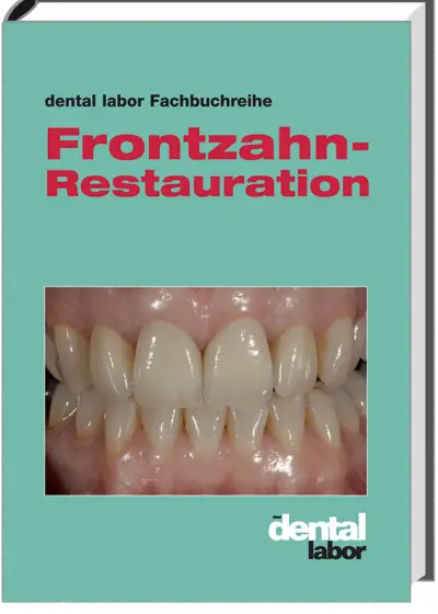 Frontzahn-Restauration
