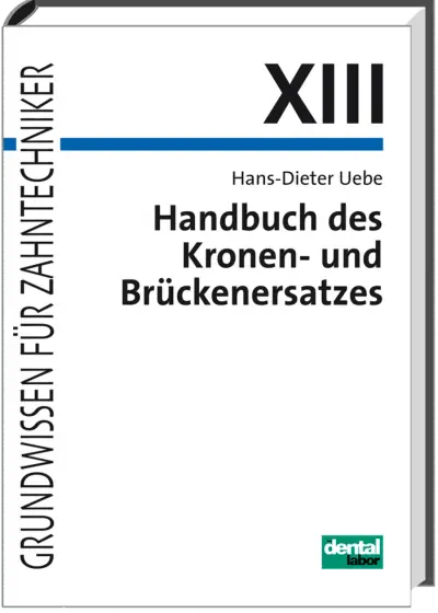 Handbuch Kronen- und Brückenersatz