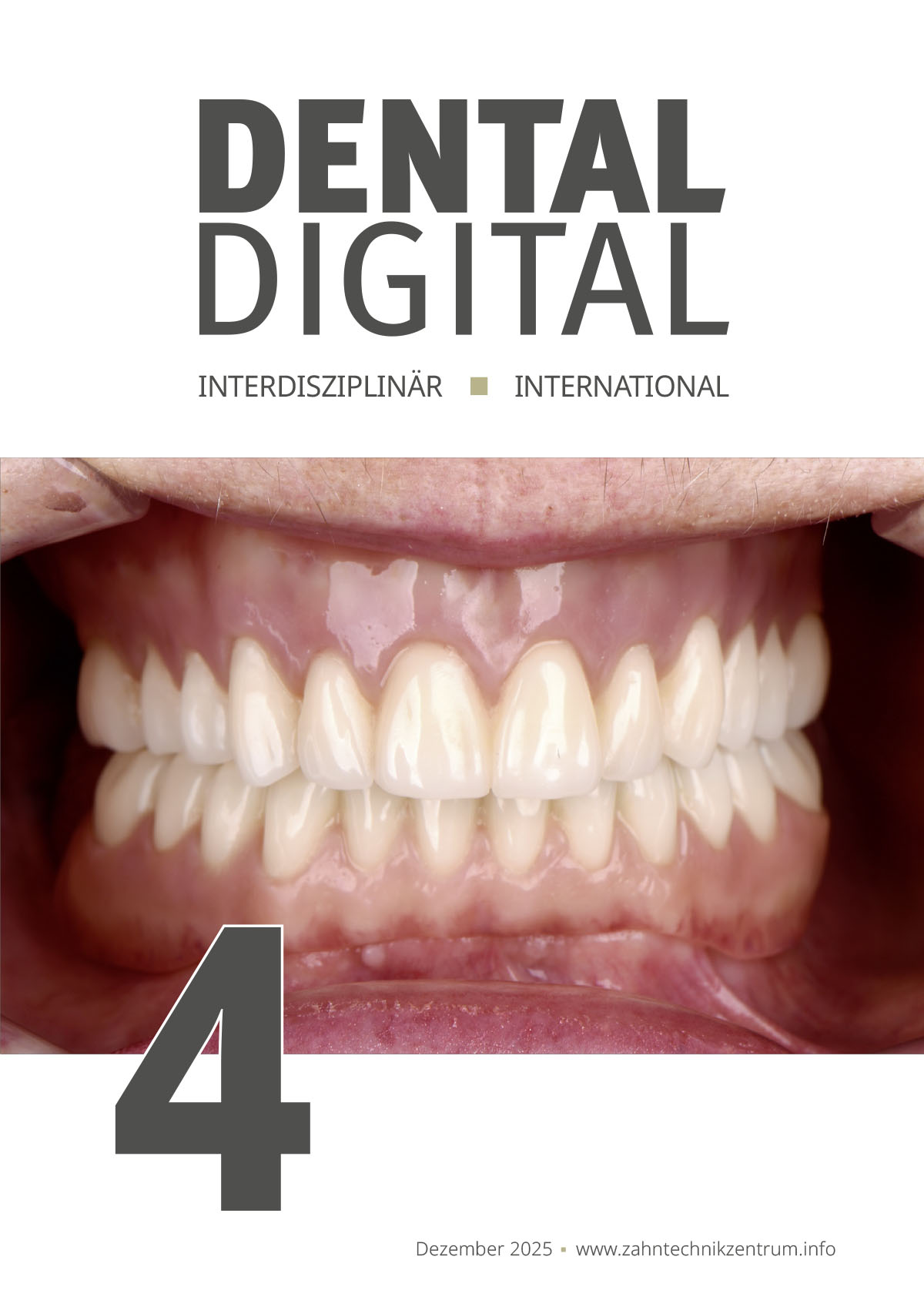 Mehr über den Artikel erfahren Dental Digital, Ausgabe 2025/4