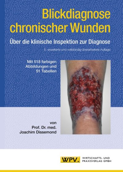 Blickdiagnose chronischer Wunden